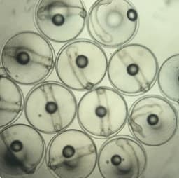 Eggs seen under the microscope